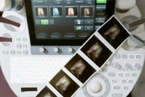 Mother & Baby Therapy For Manual Therapists – Module 3